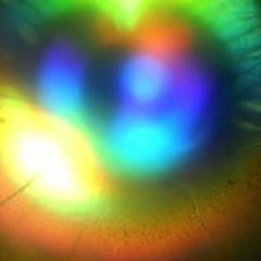 Machine vision