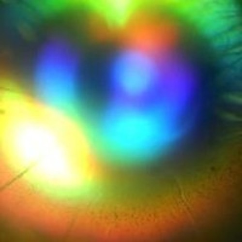 Machine vision