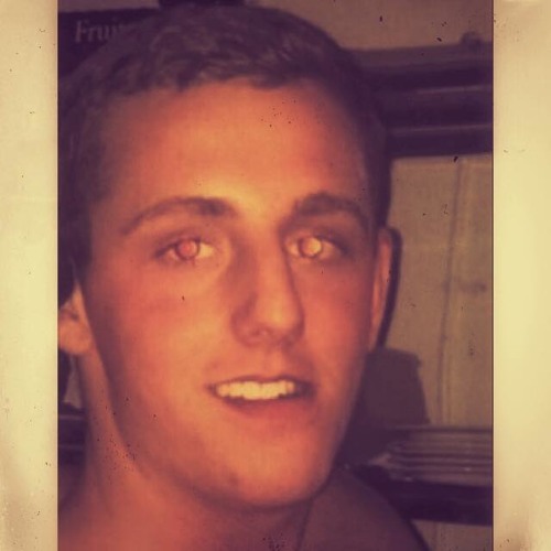 Dådyrøjne og ondt i kæben