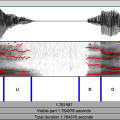 Excitation pattern 12