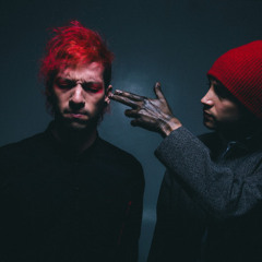 Migraine And Stressed Out