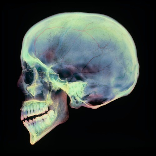 Череп арины глазуновой после падения фото рентгена Stream Basilar Skull Fracture by knulletje Listen online for free on SoundCloud