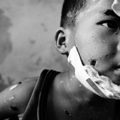 The impact of cluster bombs on humans, and how to clear them