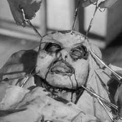 Dark Arts - Removal Time