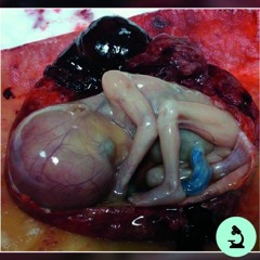 (A)Venire Precoce - Fiike Makeshi (30 mins)