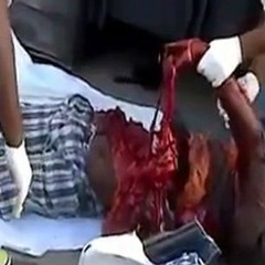 [012] Glans Penis - I Will Rip Your Guts Out