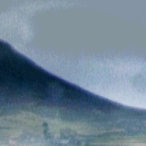 09 MDS