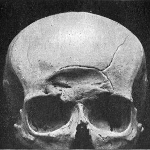 Skull Stretcher (FREE DOWNLOAD)