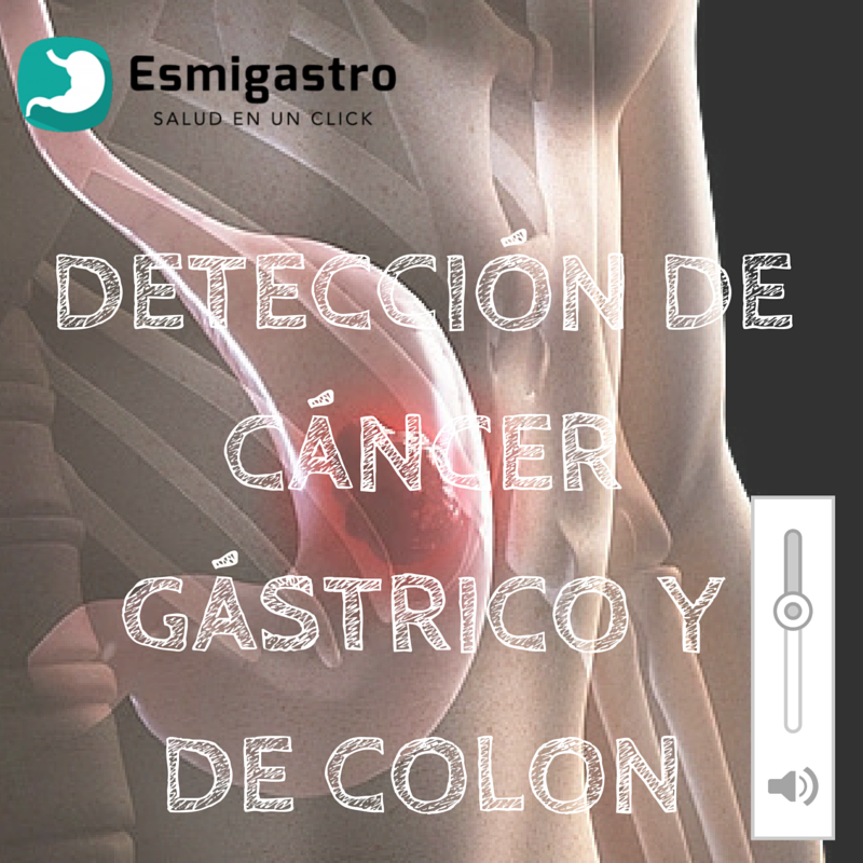 Detección de cáncer gástrico y de colon episode artwork