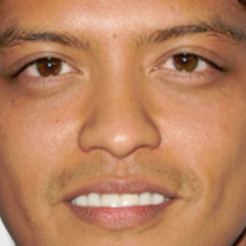 Through The Bruno And The Mars