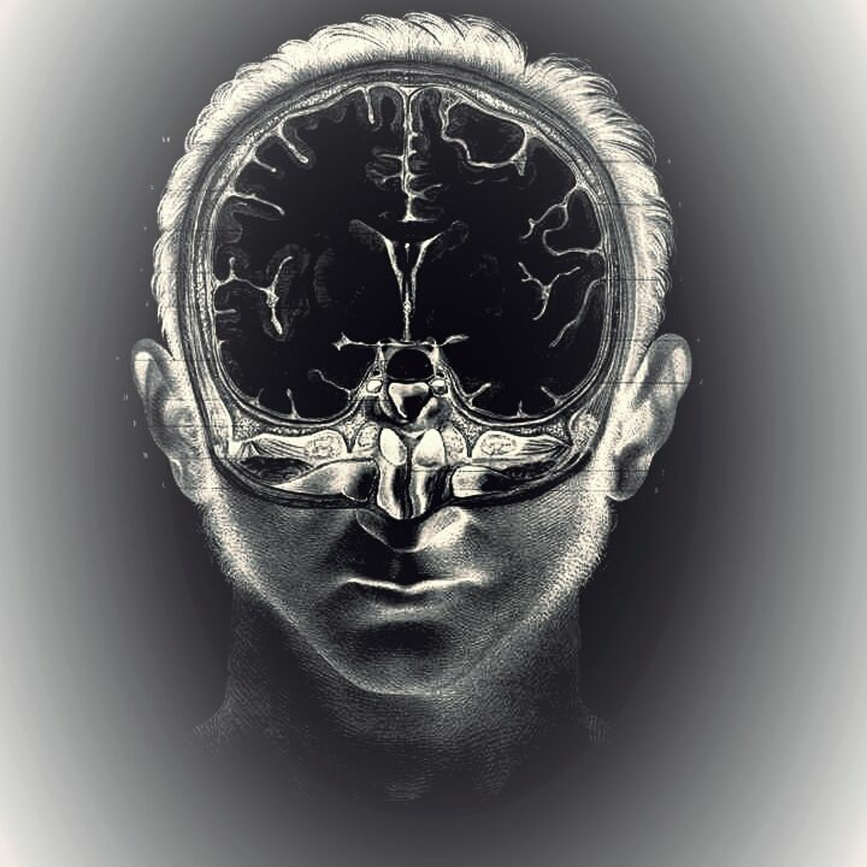 Sonder episode artwork