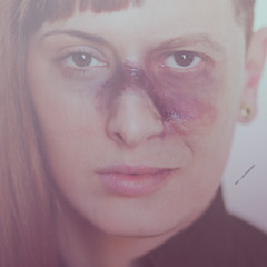 B1 - Sospiro Latenza