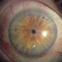 envy arcadia- Pinpoints