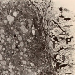 Gravel (2015) demo recording