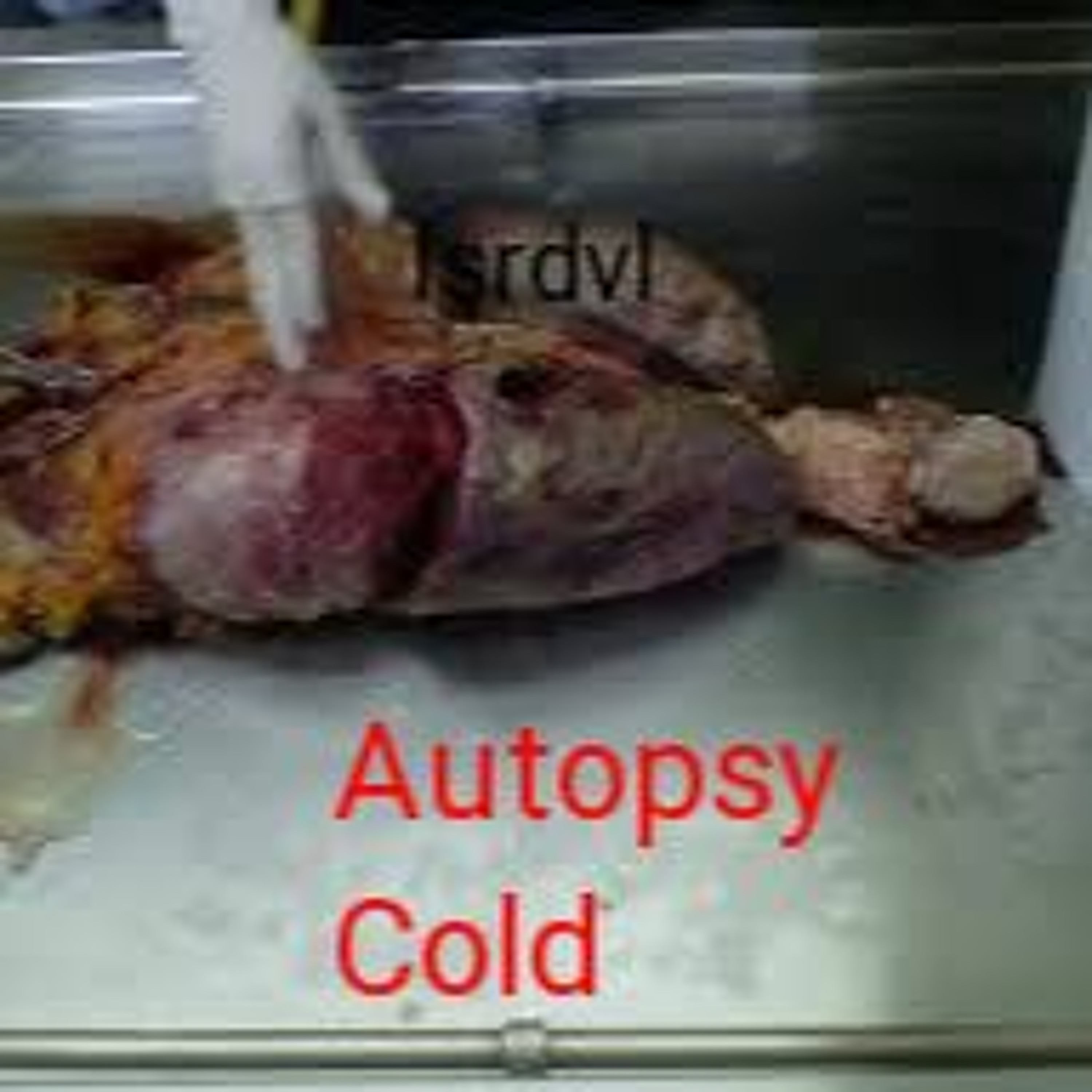 Autopsy Cold episode artwork