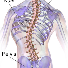 scoliosis