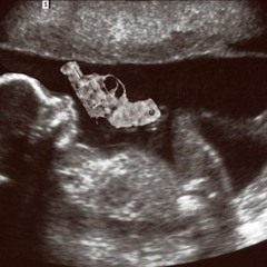 Joey Knoxx - Here produced by Buk Dollar & Bennie Beatz,(Puro Material, BeatWeizer)