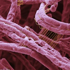 DisTrick - Anthrax Demo