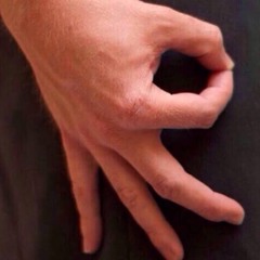 Jackie wants a black eye