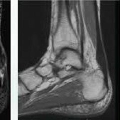 Tendon Neuroplastic Training With Ebonie Rio