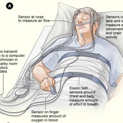 Sleep Study