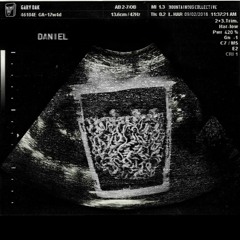 Gary Oak - Cup Noodle ( "DANIEL" OUT NOW ON MNTNS BANDCAMP )