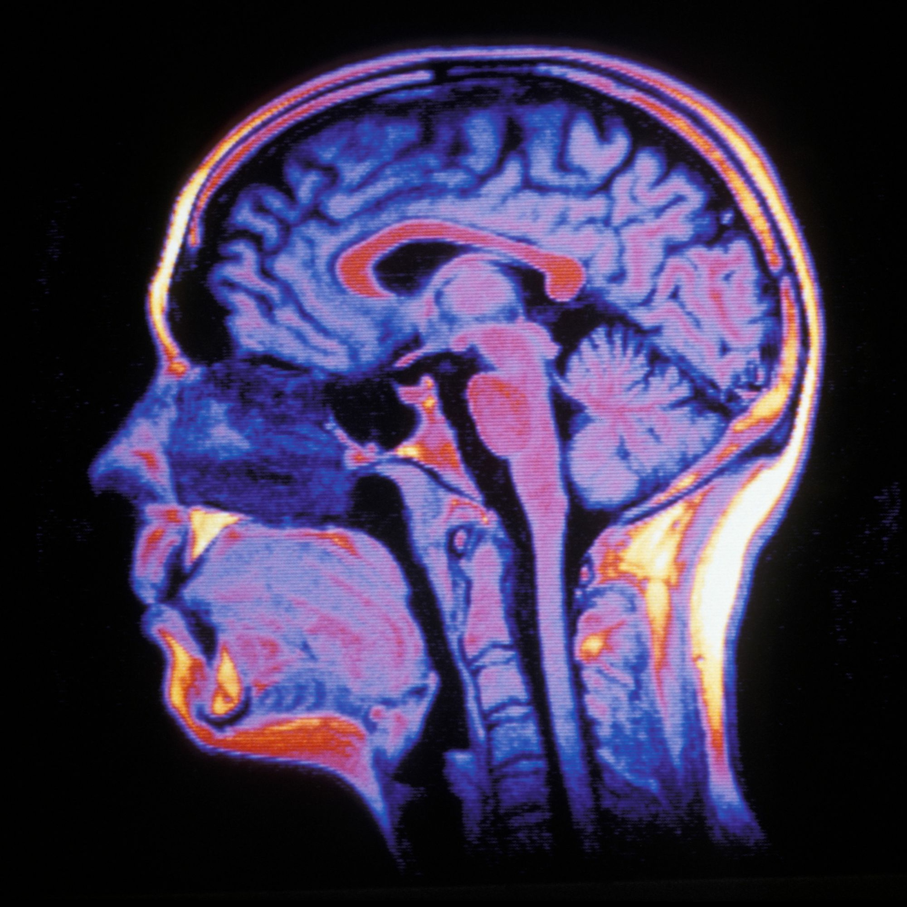 Psylocida