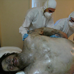 AGONIZING SEPSIS-larvae consumed by blowflies on a bloated corpse on a hotel mattress