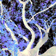 The Forest and its Kids [feat. Judge] (first edition)