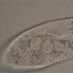The Ciliate - Paramecium Caudatum