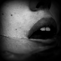 Aphonia