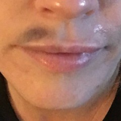 Jenny McCarthy: I blame the Kardashians for my bruised lip