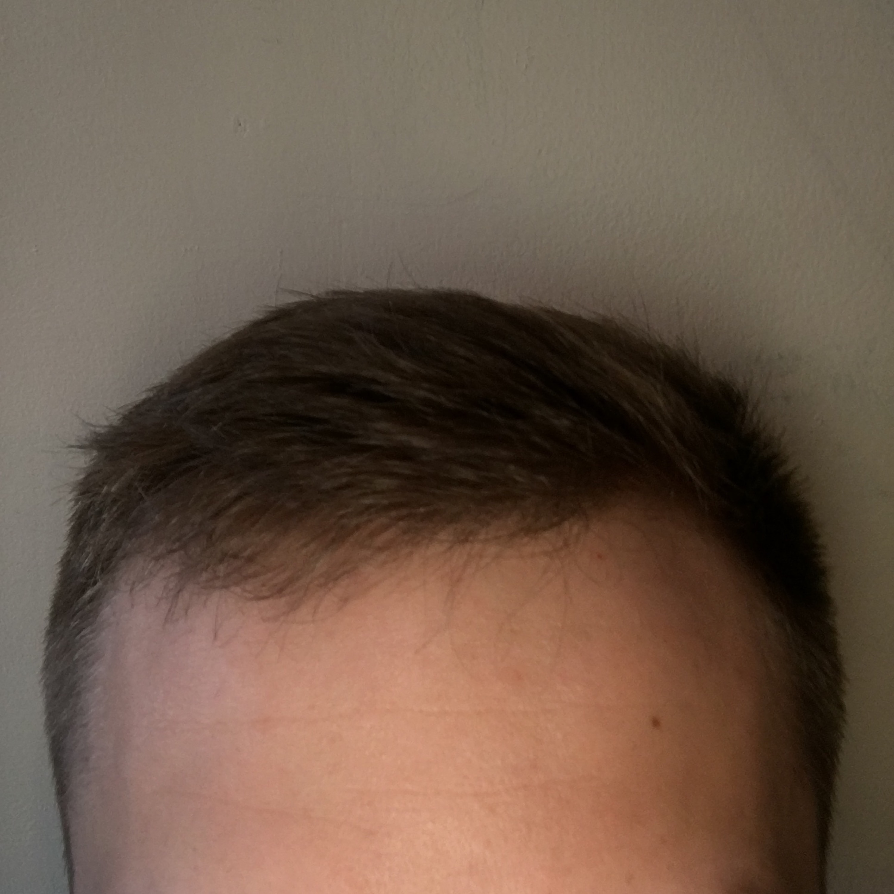 Haircut