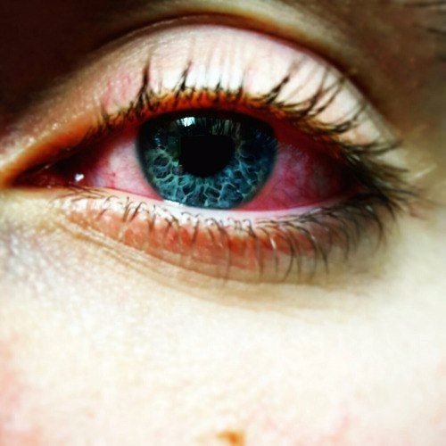 Boris Brejcha - - Euphoria