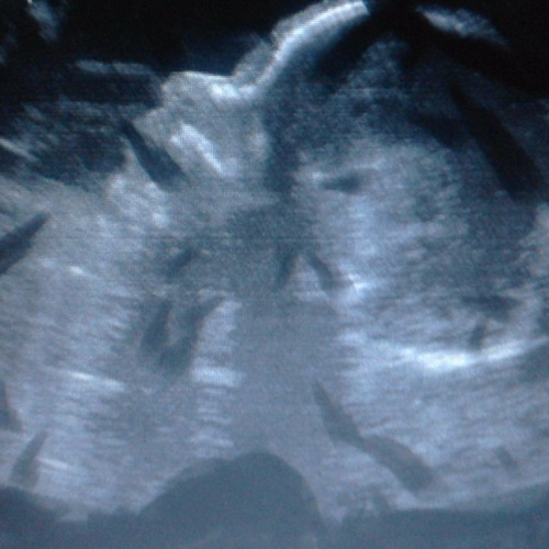 Bit Phi - Ruvio (Original Mix Preview)