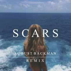 James Bay - Scars (AGST Remix)