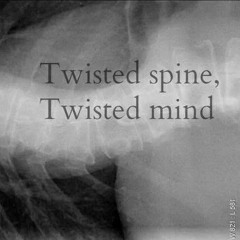 Secondhand Serenade - Half Alive (Short Cover)