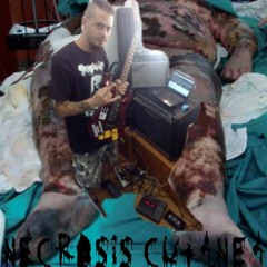 NECROSIS CUTANEA(NECROSIS POR TRATAMIENTO ANTICOAGULANTE ORAL)