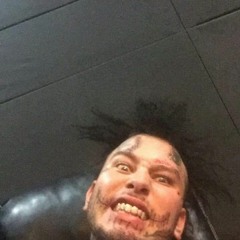 Stitches – Spaz Out