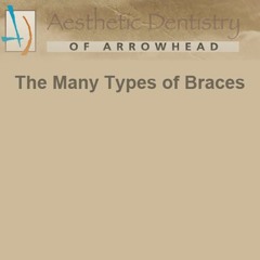 The Many Types of Braces | Aesthetic Dentistry of Arrowhead