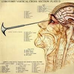 Gary Bundy - Mental Issues