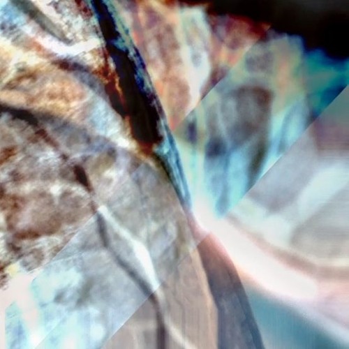 Hallucinations