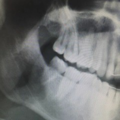 the ymca down the street from the clinic (cover)