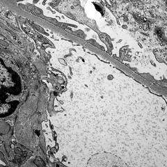 Tenoch & Inure - Disease