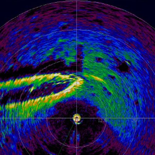 Lunar Sonar Quasar 3pointZero