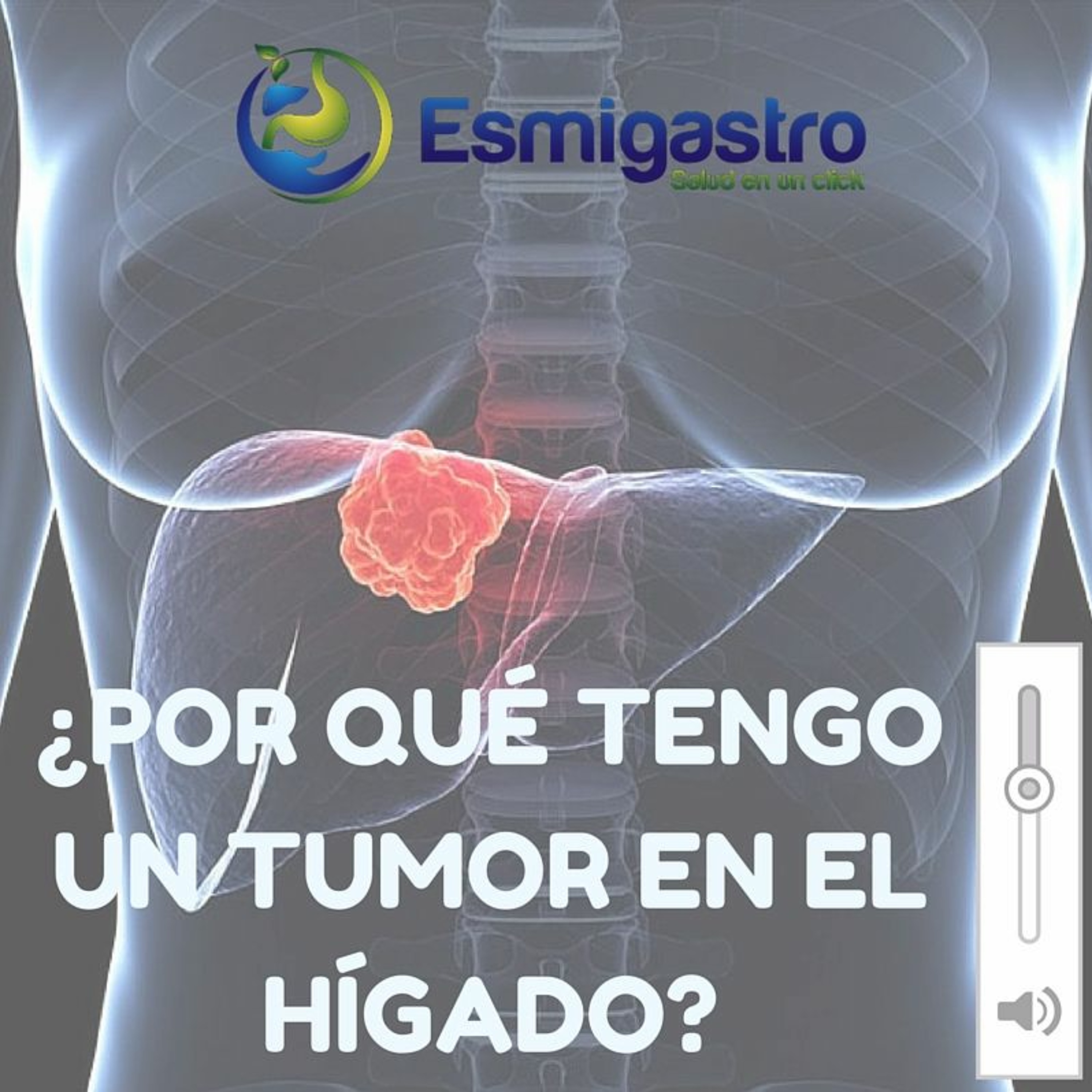 ¿Por qué tengo un tumor en el hígado? episode artwork