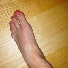 Tånegle I Dit Hår (feat. RødPeder)