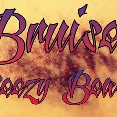 Bruises
