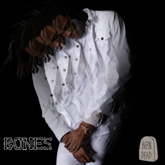 Bones