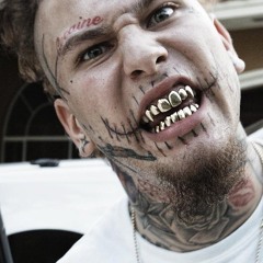 Stitches - Brick In Yo Face